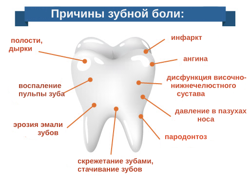 Что делать если после отбеливания болят зубы