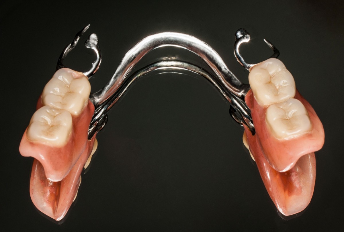 Акриловые зубные протезы отзывы и цены в москве