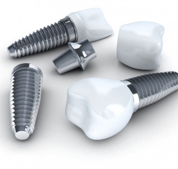 Имплантация зубов под ключ. Стоматология Максима Шубных
